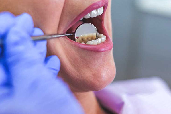 آبسه دندان و راه‌های درمان آن