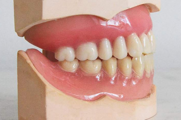 مشکلات پروتز کامل دندان